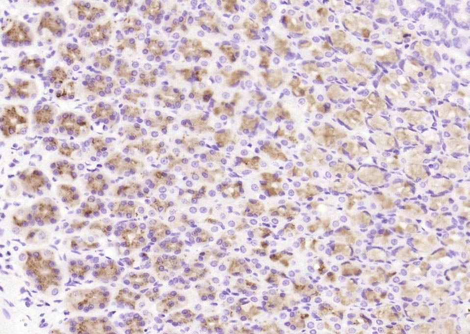 Anti-CCDC80 Polyclonal Antibody