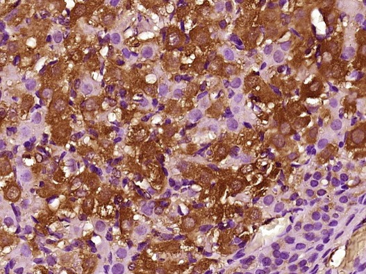 Anti-CCL26 Polyclonal Antibody