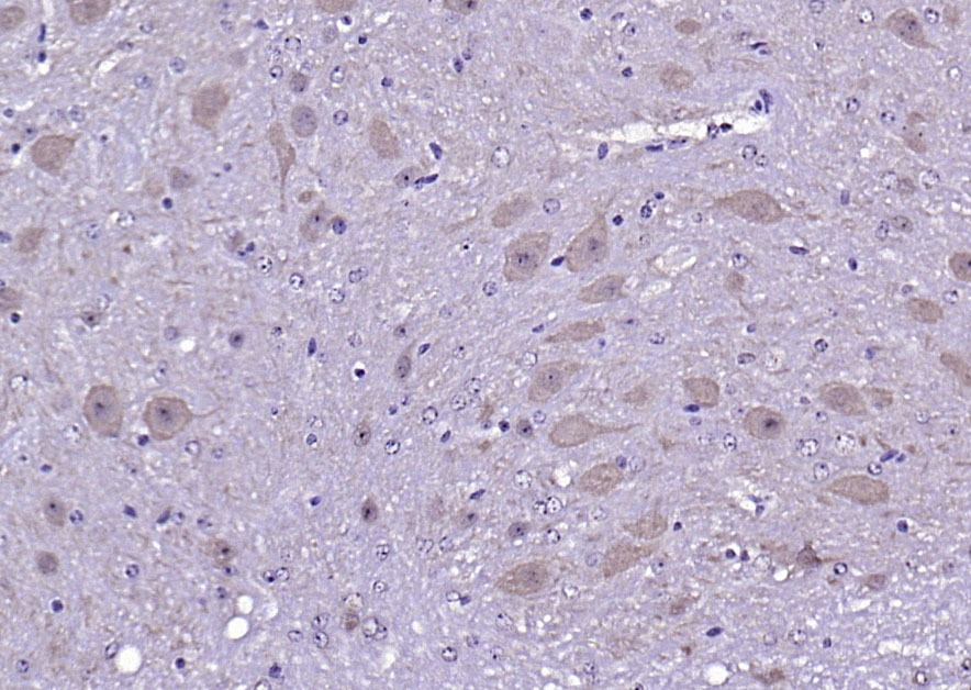 Anti-CALM1 Polyclonal Antibody