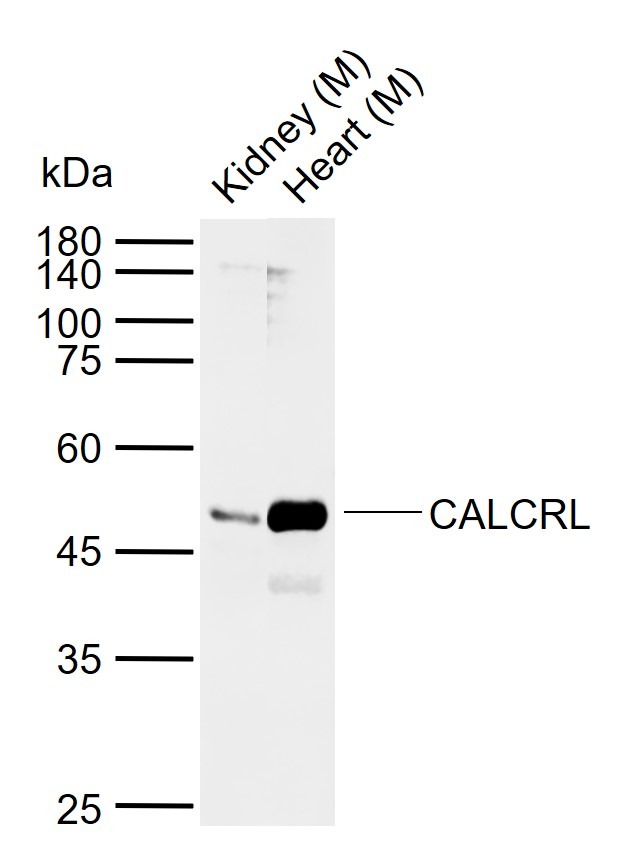 Anti-CALCRL Polyclonal Antibody