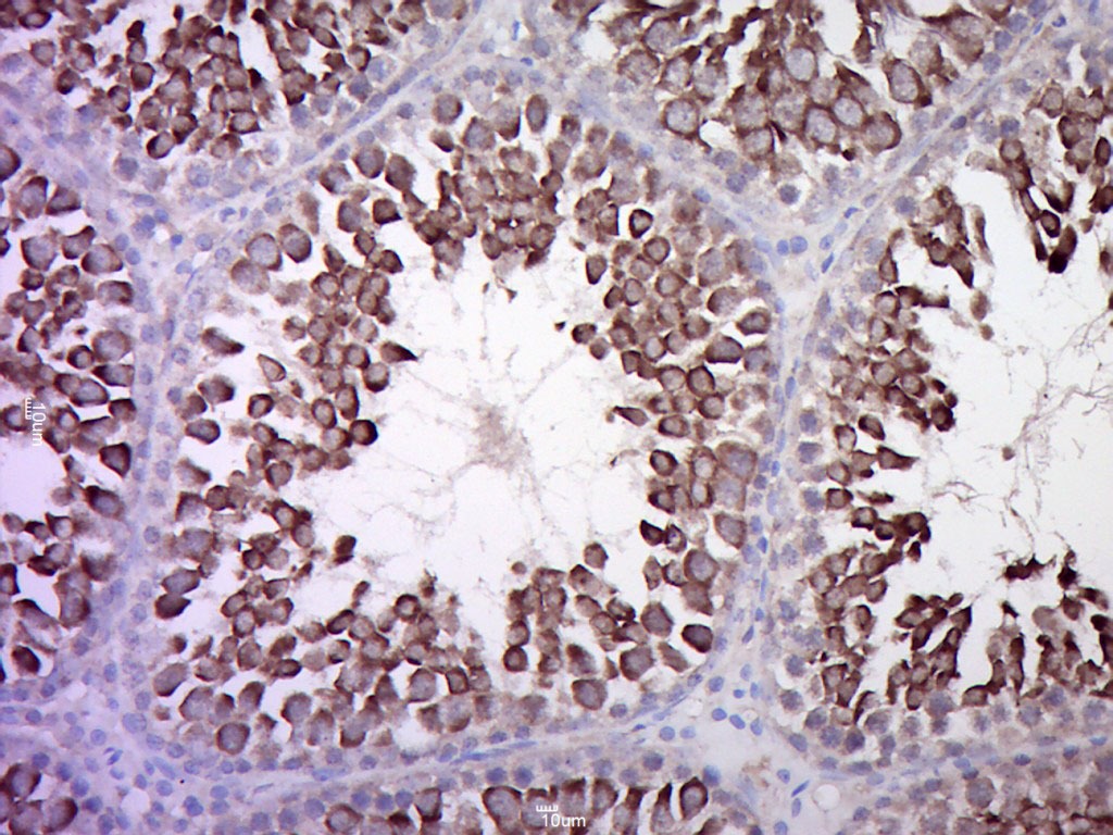 Anti-Calcitonin receptor Polyclonal Antibody