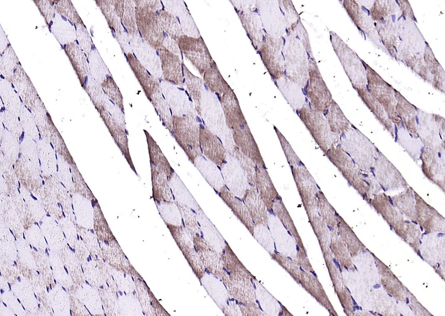 Anti-CALM1 Polyclonal Antibody