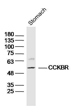 Anti-CCKBR Polyclonal Antibody