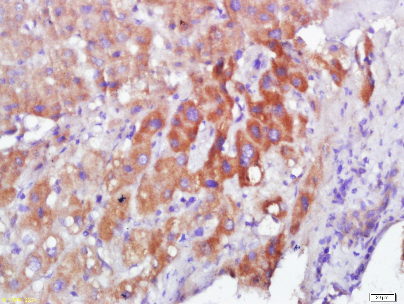 Anti-CALM1 Polyclonal Antibody
