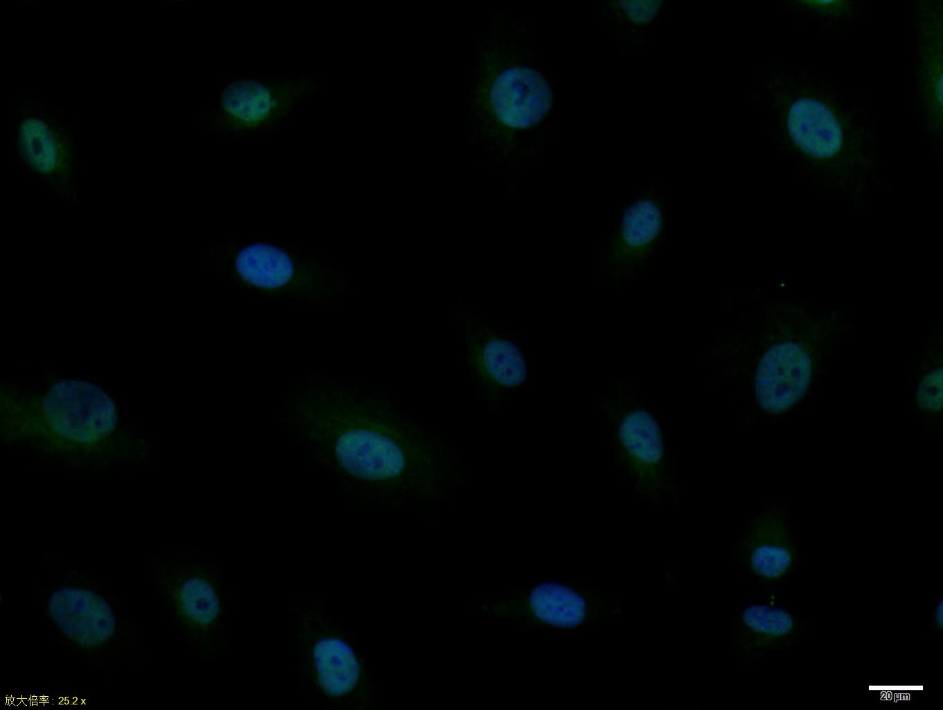 Anti-ASCL1 Polyclonal Antibody