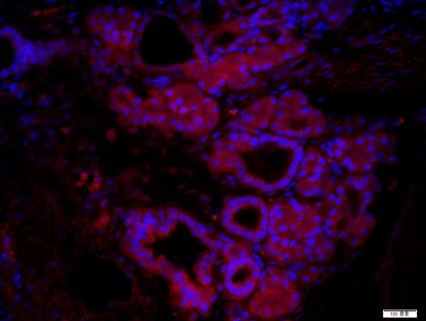 Anti-BCL2 Polyclonal Antibody