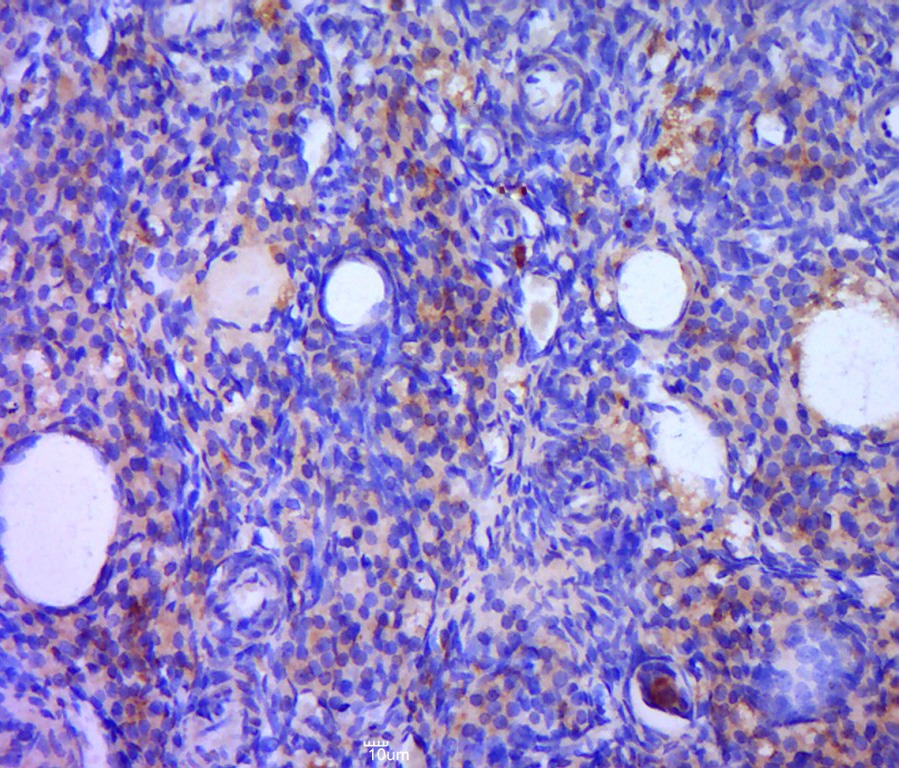 Anti-BCL2 Polyclonal Antibody