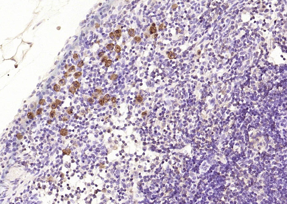Anti-BCL2 Antibody (5A806)