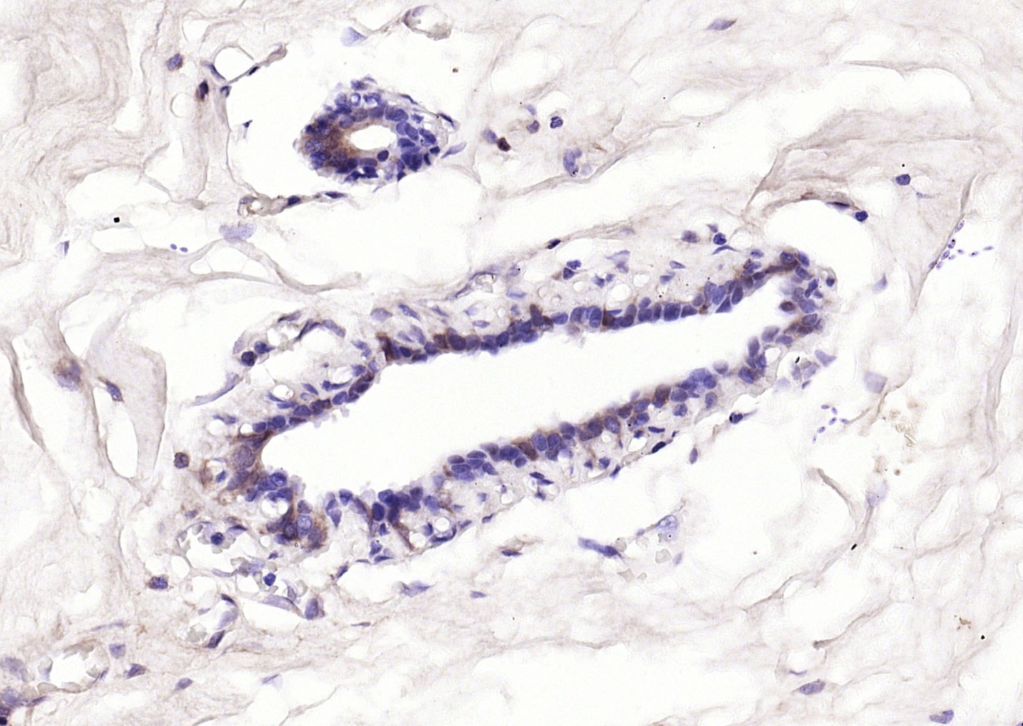Anti-BCL2 Antibody (5A806)