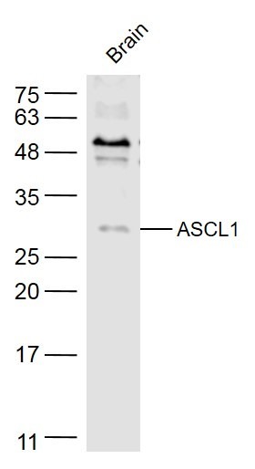Anti-ASCL1 Polyclonal Antibody
