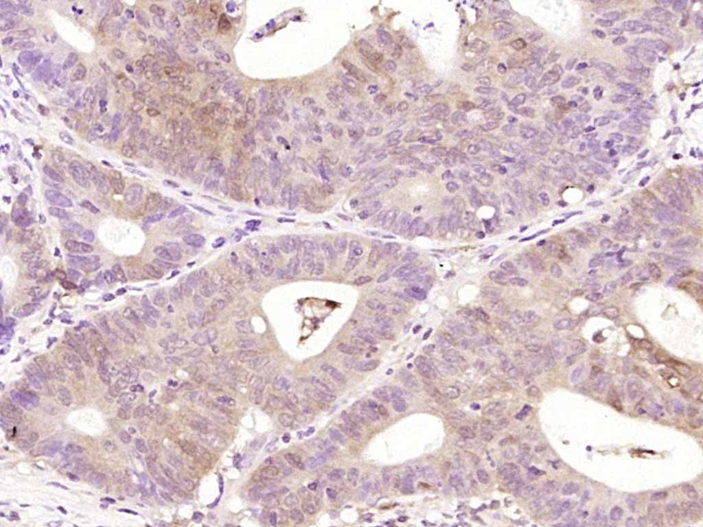 Anti-BCL2 Antibody (2P100)