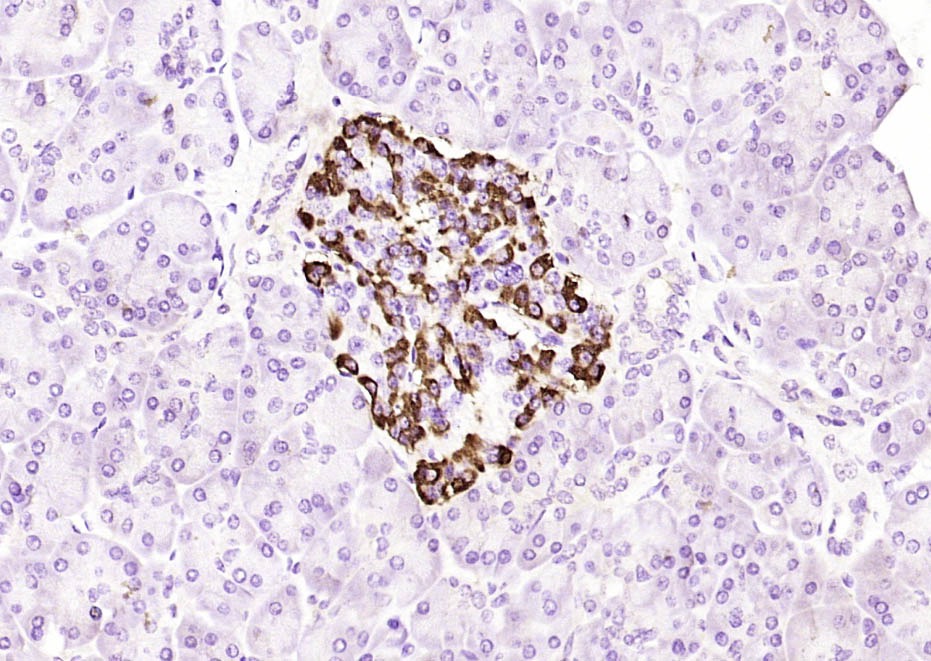 Anti-BCL2 Antibody (5A806)