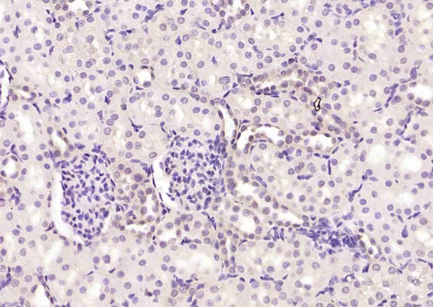 Anti-BCL2 Antibody (2P100)