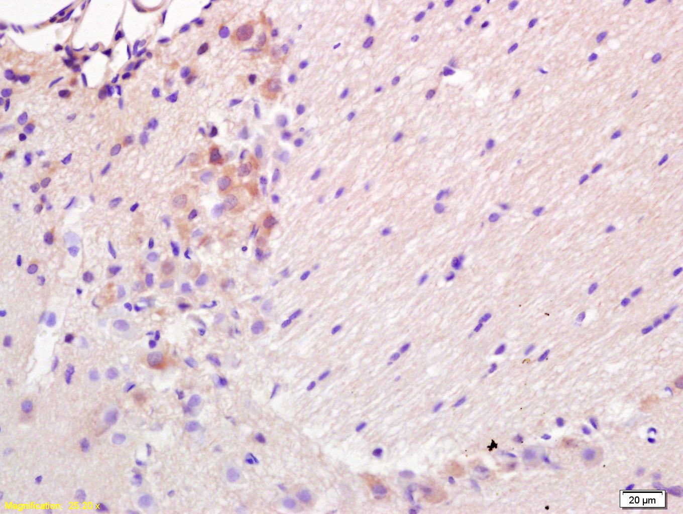 Anti-BBC3/PUMA Polyclonal Antibody
