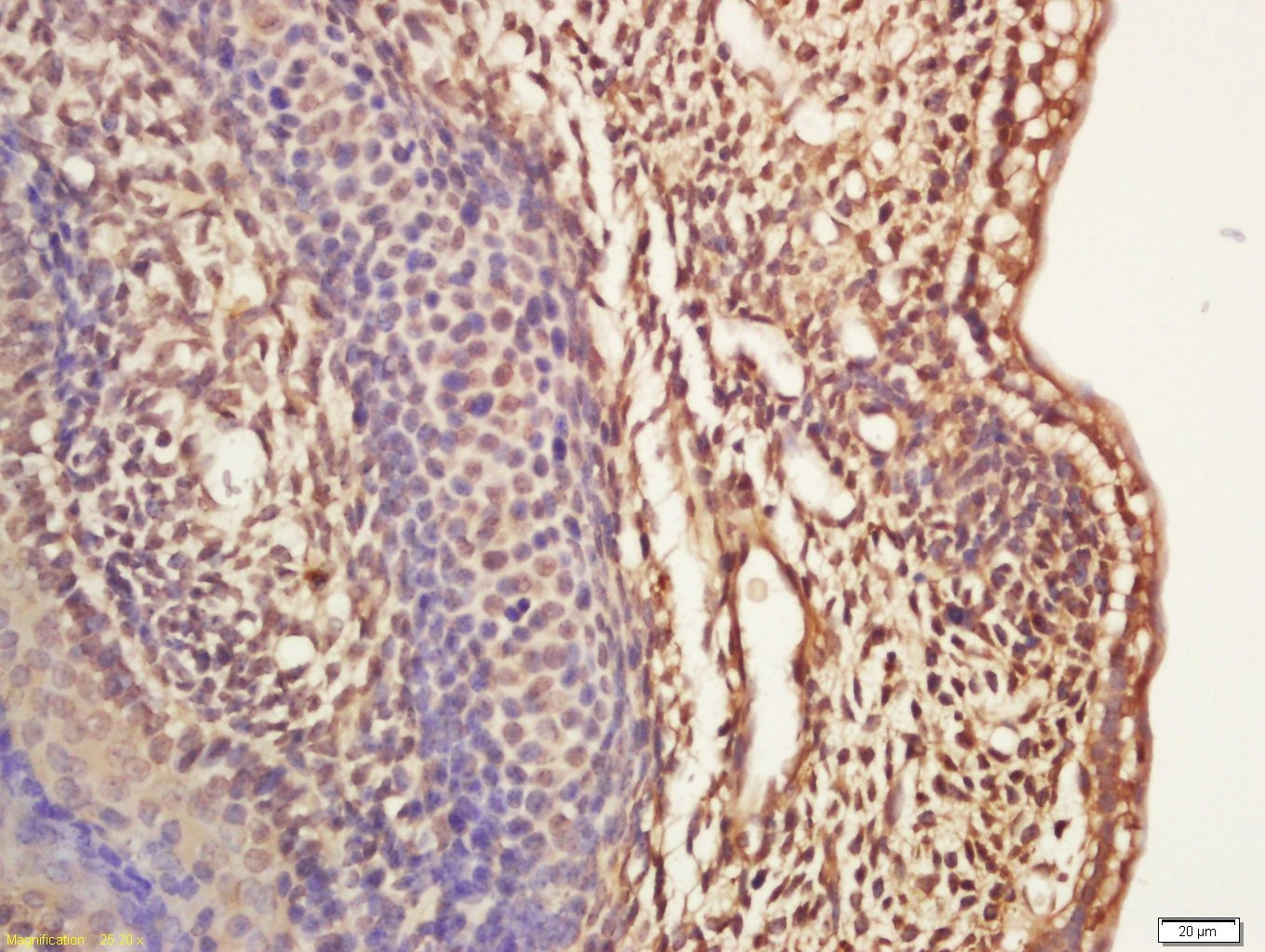 Anti-ASCL1 Polyclonal Antibody