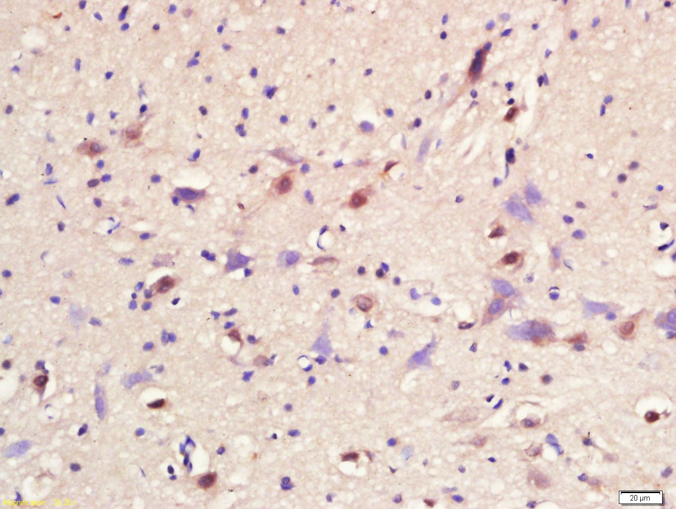 Anti-ASCL1 Polyclonal Antibody