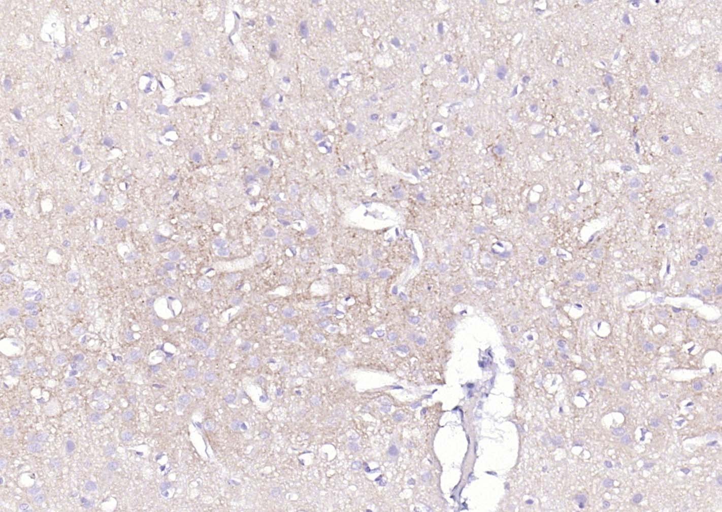 Anti-ATP1A1 Polyclonal Antibody 2