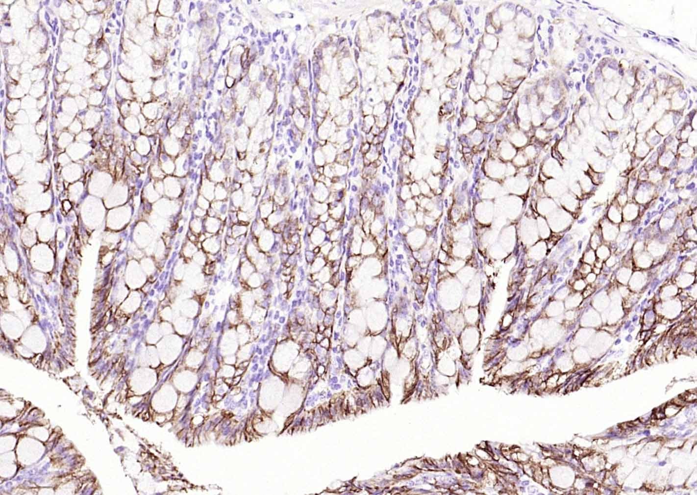 Anti-ATP1A1 Polyclonal Antibody 2