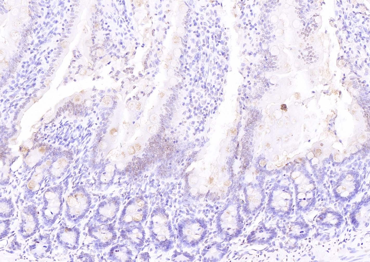 Anti-ATF-4 Polyclonal Antibody