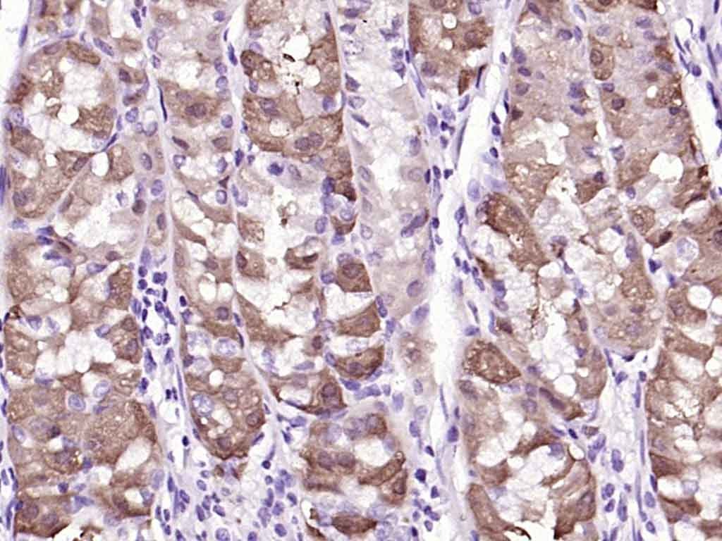 Anti-ATG5 Polyclonal Antibody