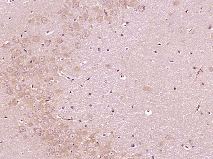 Anti-BCL2 Polyclonal Antibody