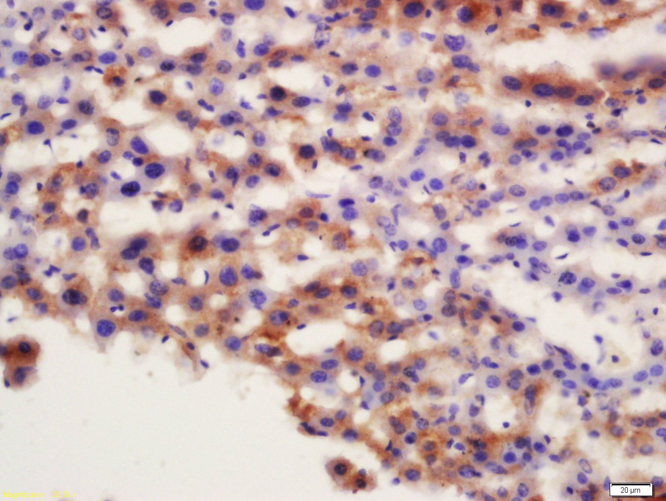 Anti-ATG7 Polyclonal Antibody