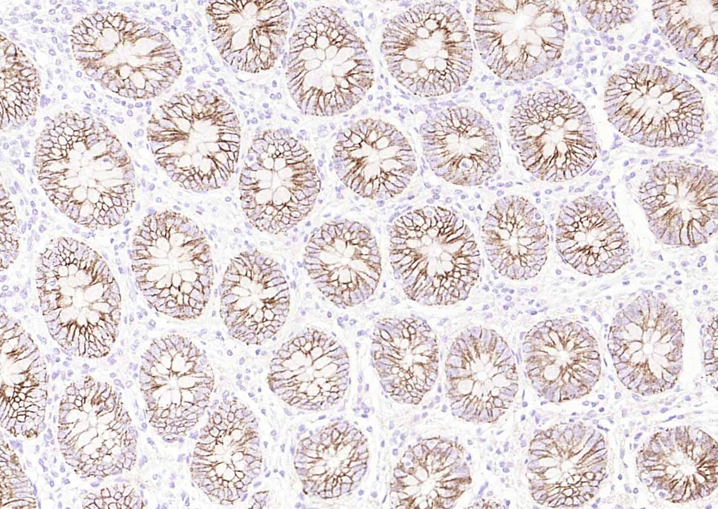 Anti-ATP1A1 Polyclonal Antibody 2