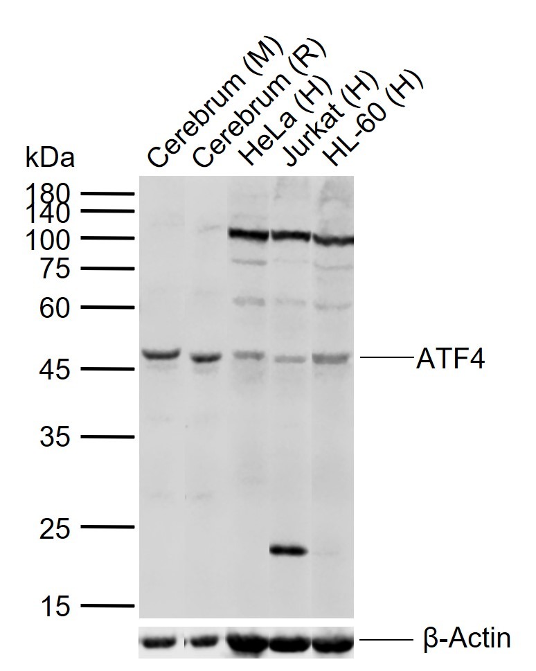 Anti-ATF-4 Polyclonal Antibody