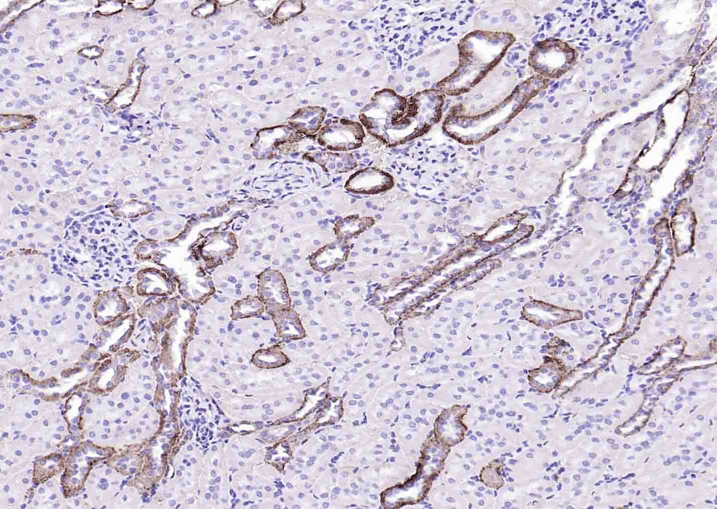 Anti-ATP1A1 Polyclonal Antibody 2