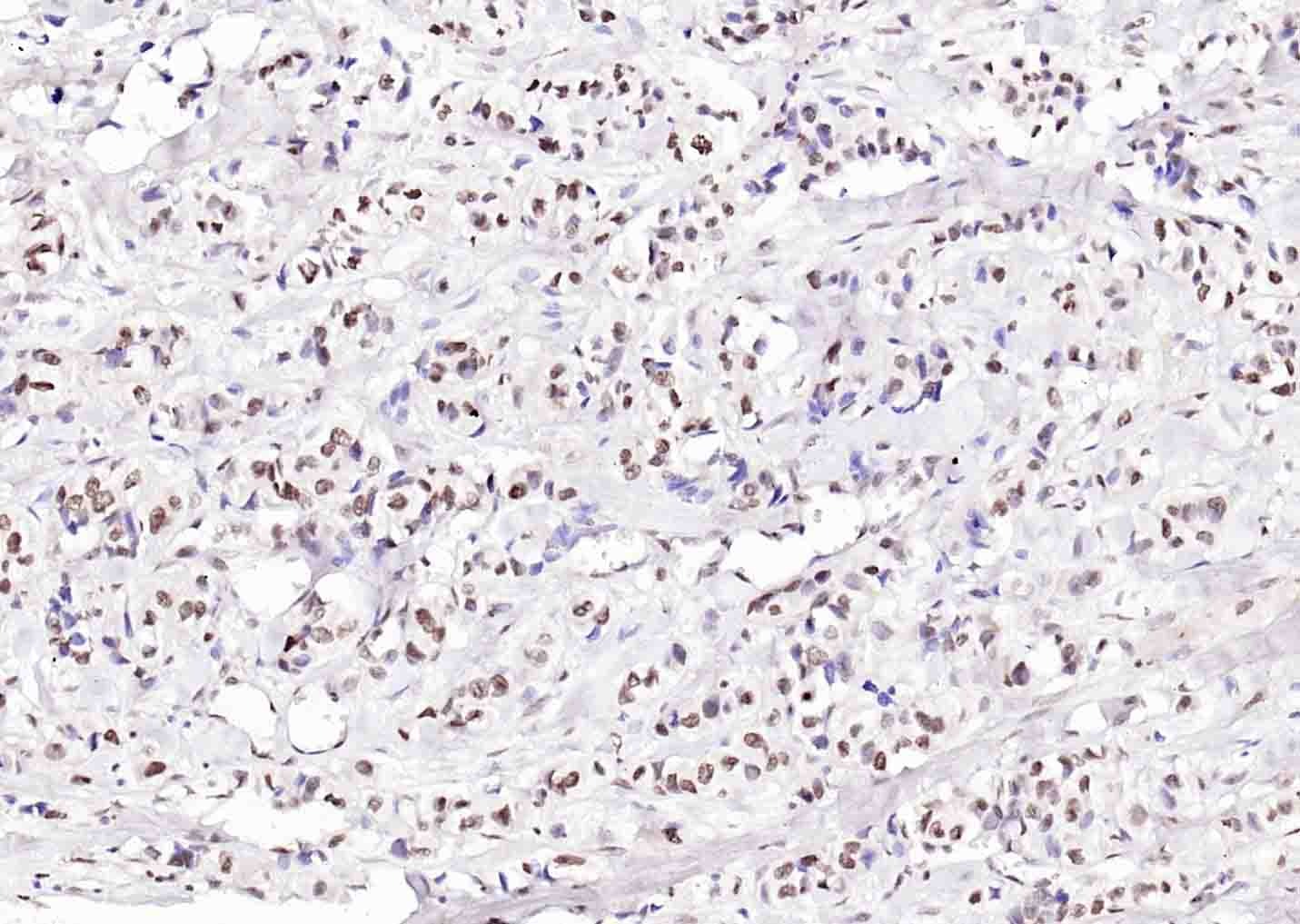 Anti-ATF-4 Polyclonal Antibody