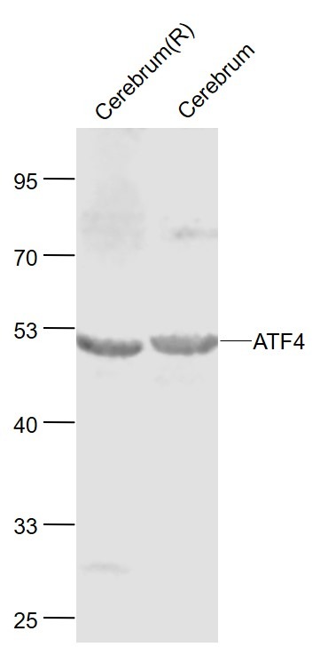 Anti-ATF-4 Polyclonal Antibody