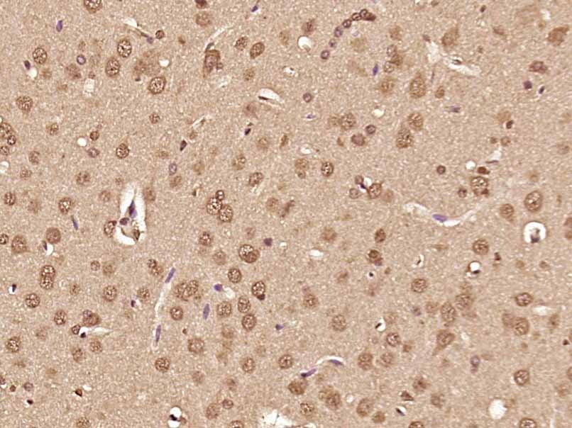 Anti-ATF-6 Polyclonal Antibody 2