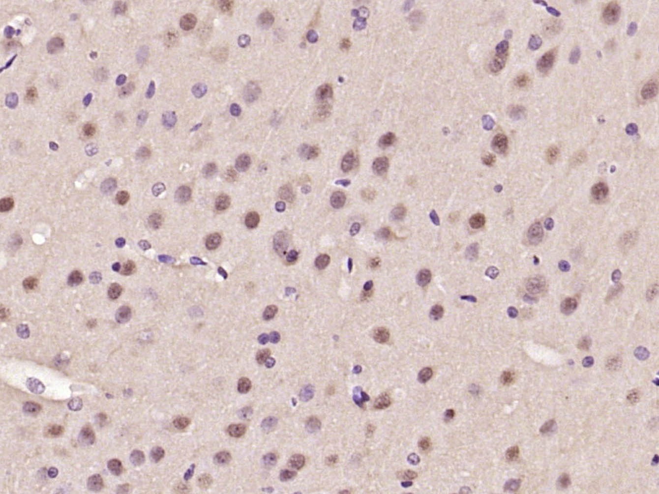 Anti-ATF-6 Polyclonal Antibody