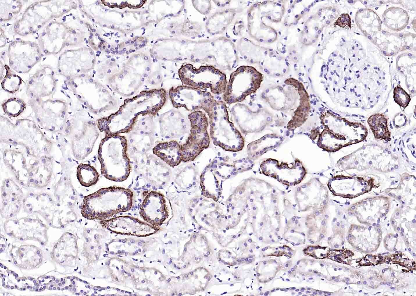 Anti-ATP1A1 Polyclonal Antibody 2