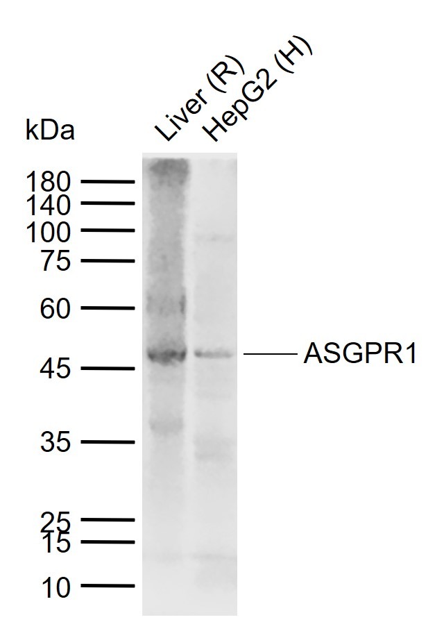 Anti-ASGR1 Polyclonal Antibody