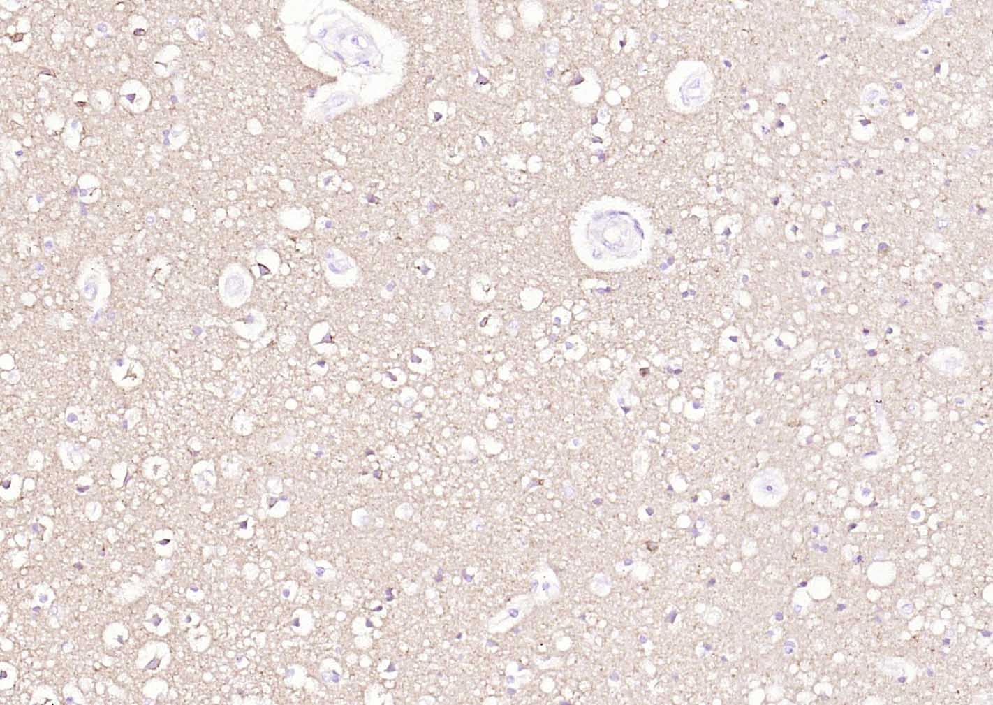 Anti-ATP1A1 Polyclonal Antibody 2