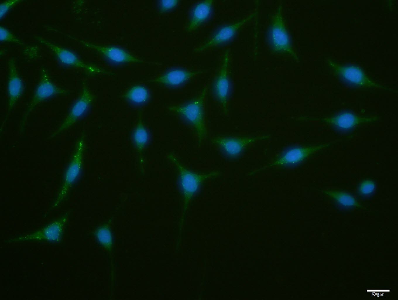 Anti-ATG1 Polyclonal Antibody