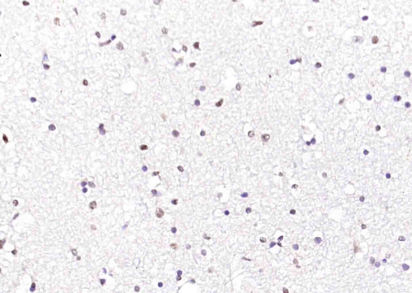 Anti-ATF-4 Polyclonal Antibody