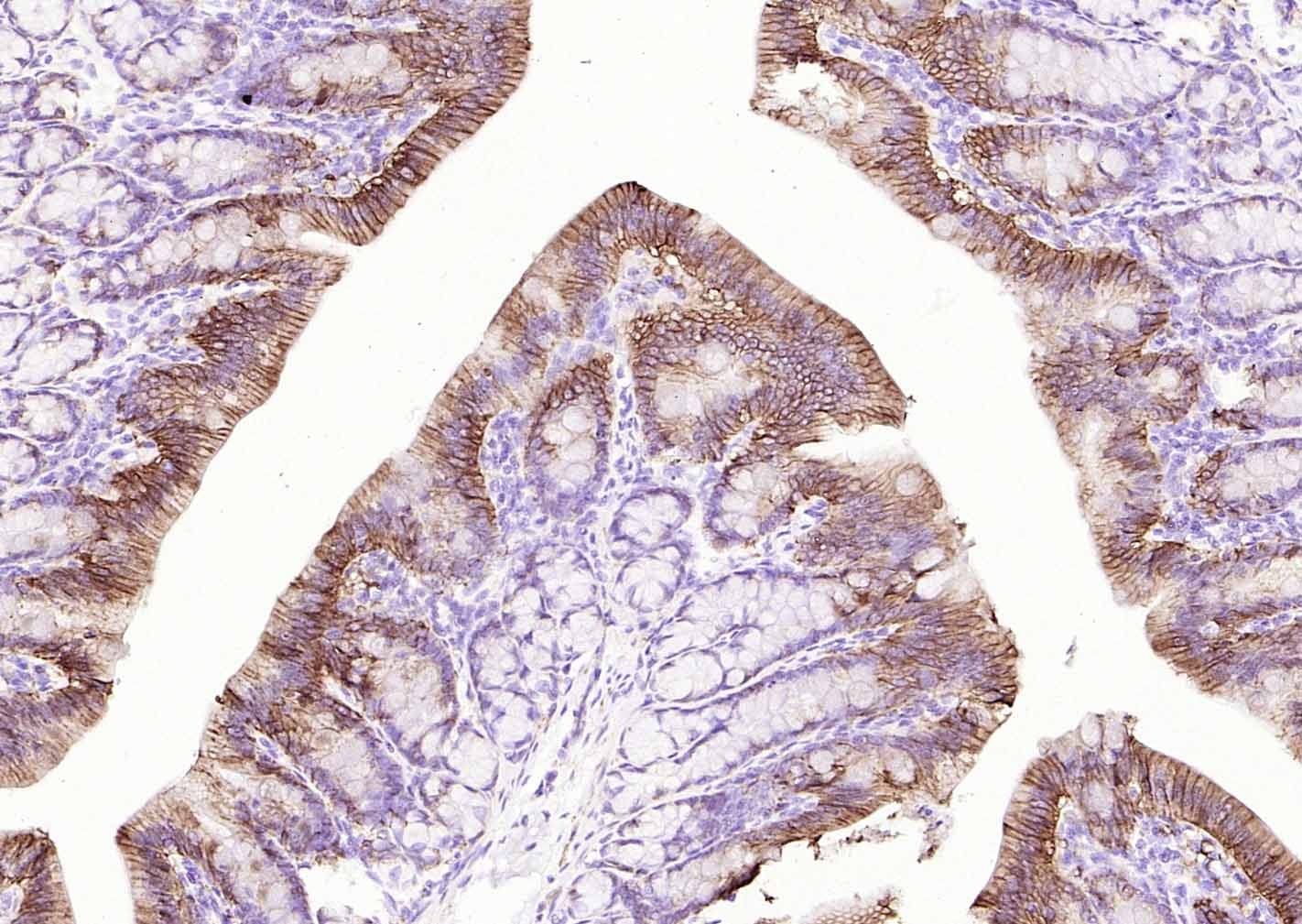 Anti-ATP1A1 Polyclonal Antibody 2