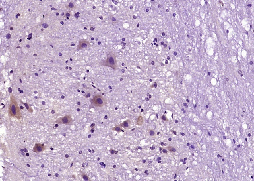 Anti-BCL2 Polyclonal Antibody