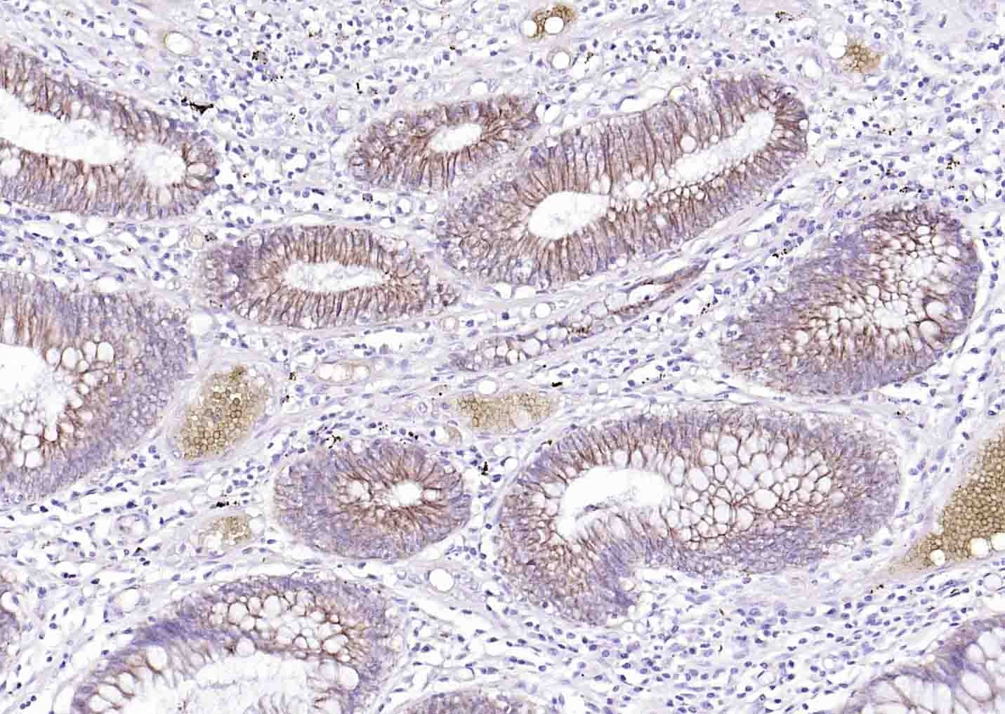 Anti-ATP1A1 Polyclonal Antibody 2