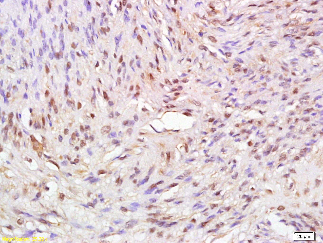 Anti-ATAD2 Polyclonal Antibody