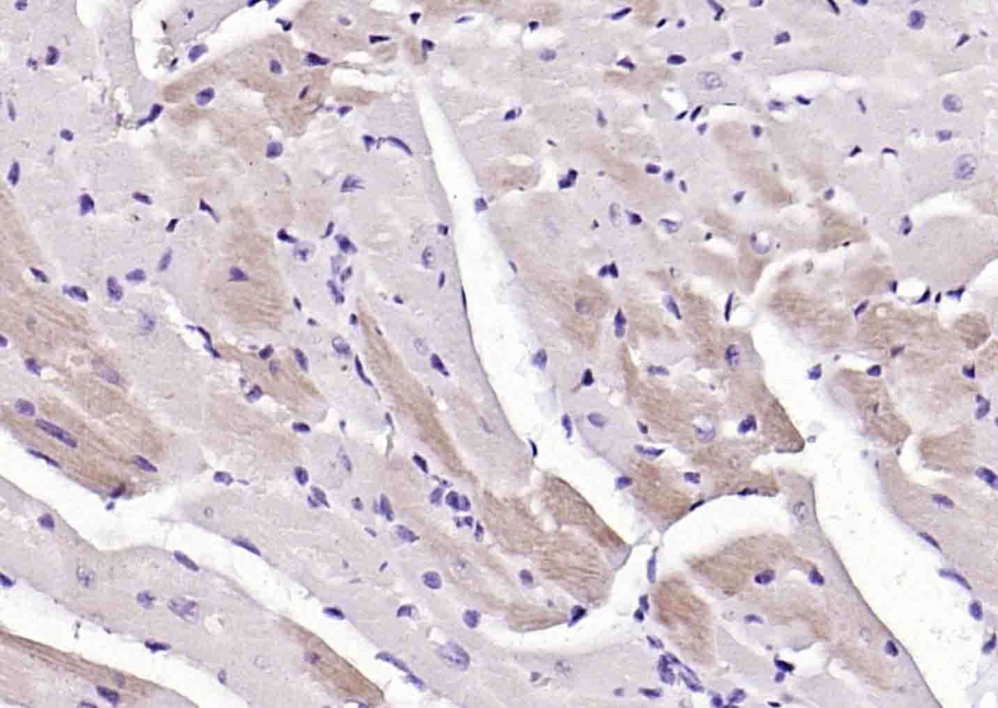Anti-ATP7A Polyclonal Antibody