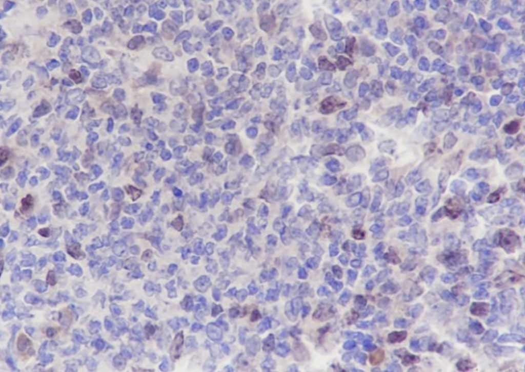 Anti-Aurora B Antibody (9I737)