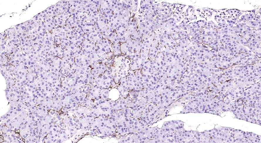 Anti-APCDD1 Polyclonal Antibody