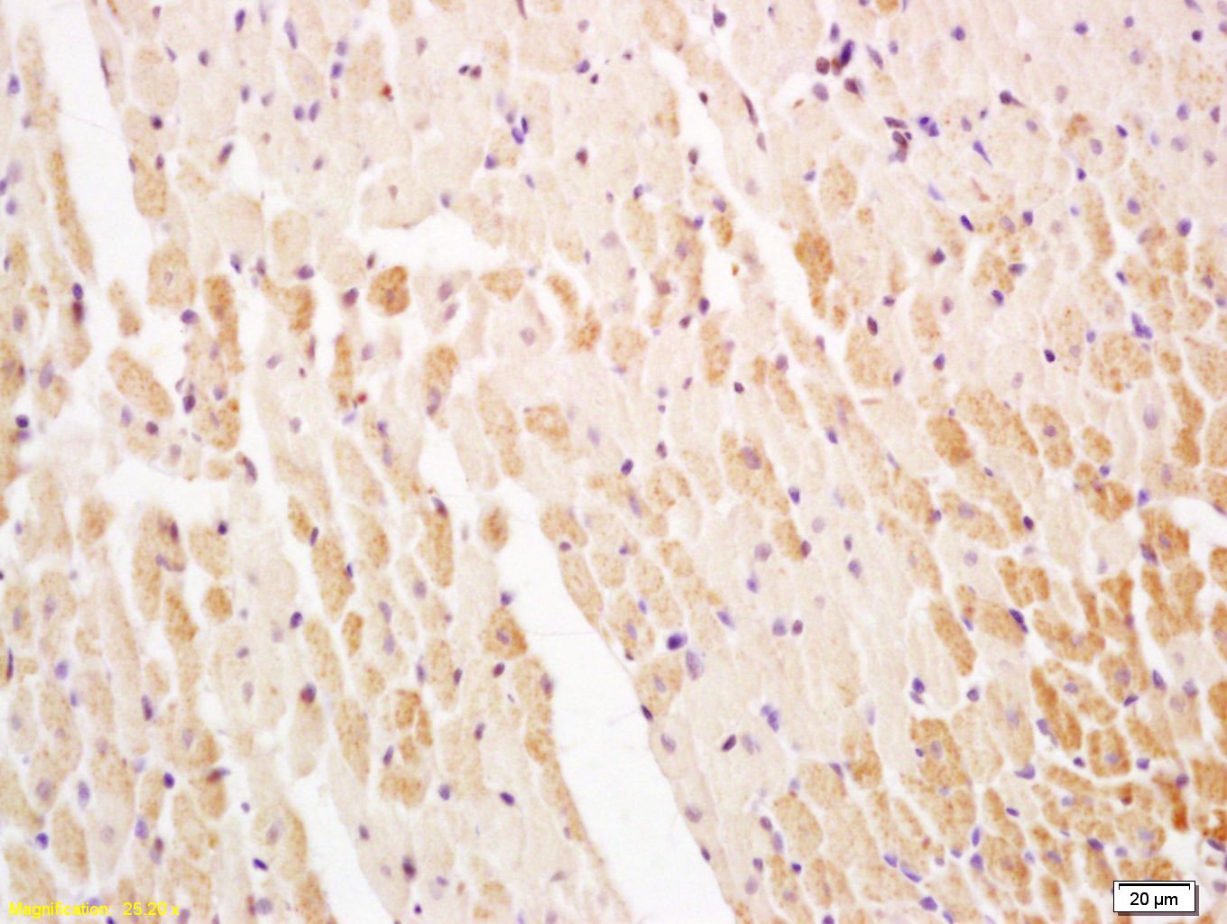 Anti-ATP2A2 Polyclonal Antibody