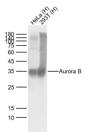 Anti-Aurora B Antibody (9I737)