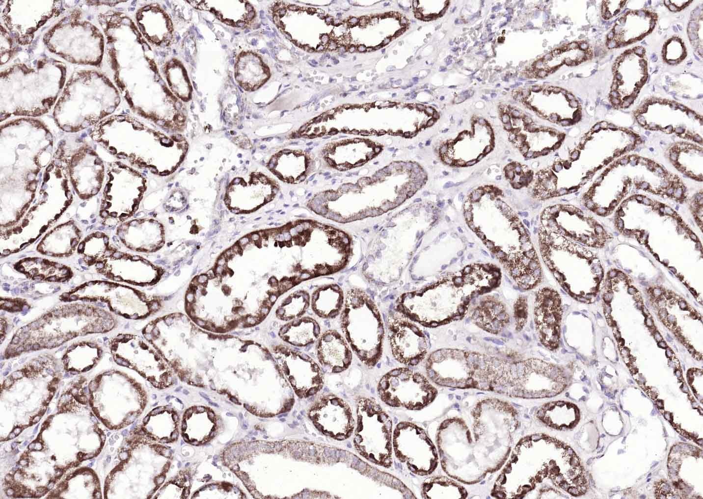 Anti-ATP7B Polyclonal Antibody