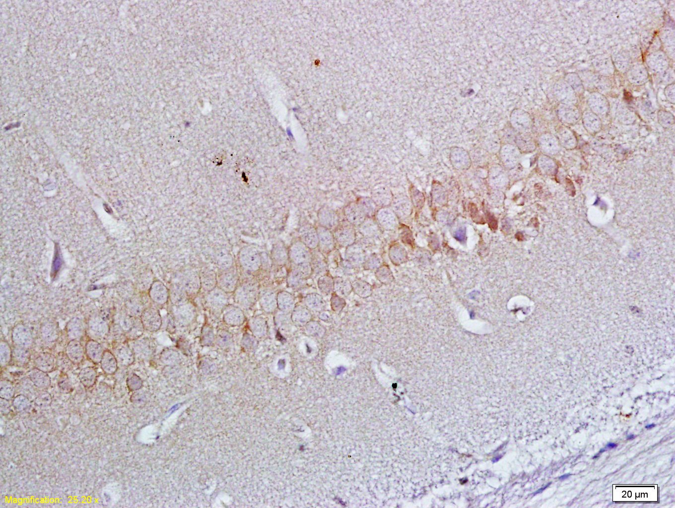 Anti-ApoER2 Polyclonal Antibody