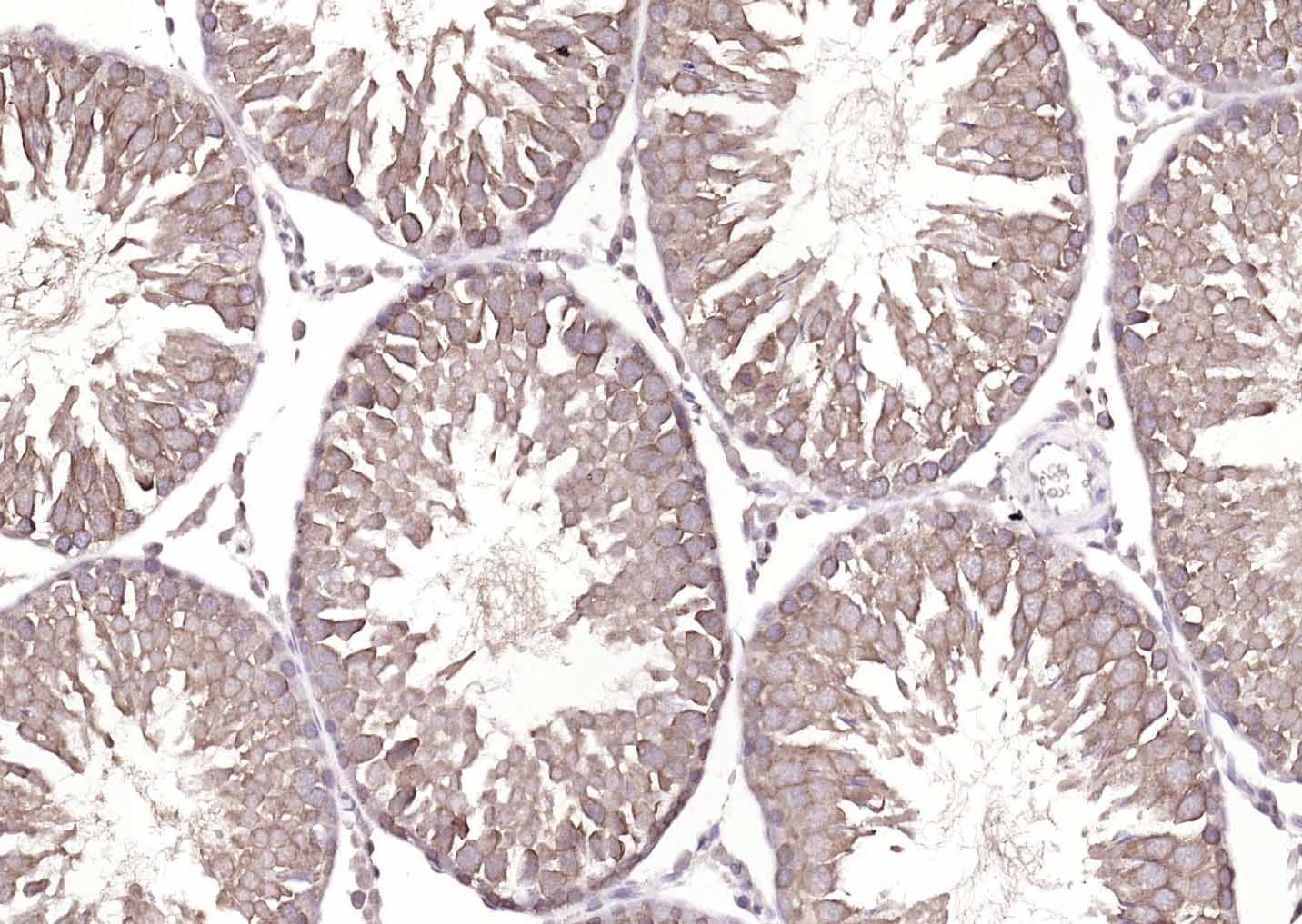 Anti-ATP7B Polyclonal Antibody